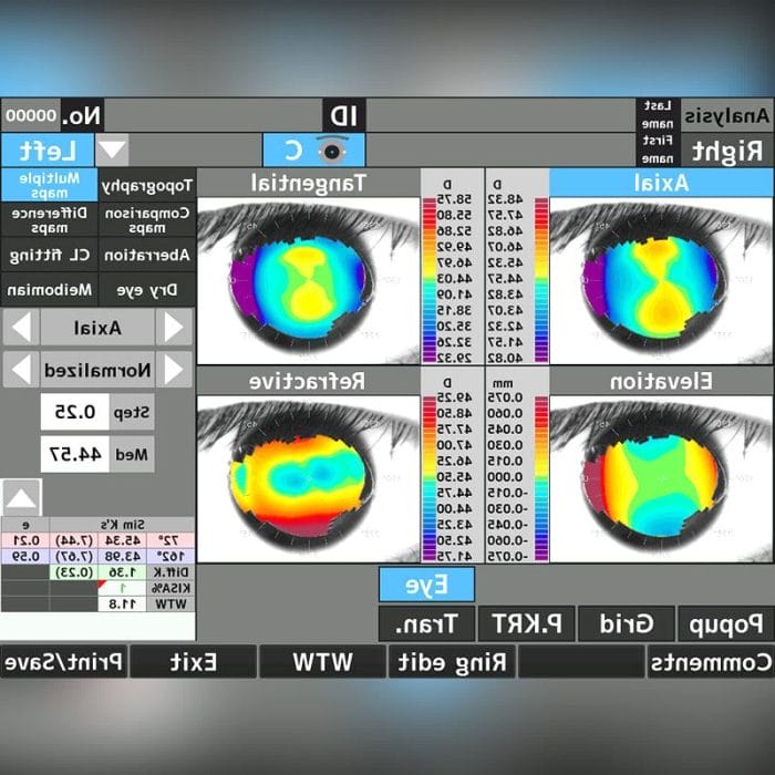 Corneal Topographer 4