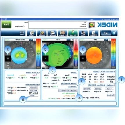 Corneal Topographer 1