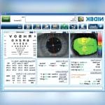 Corneal Topographer 3