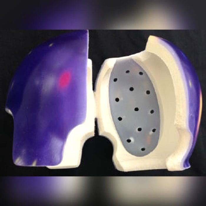 Cranial Orthosis 4