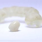 Custom Dental Prosthesis