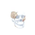 Custom-Made Cranial Implant