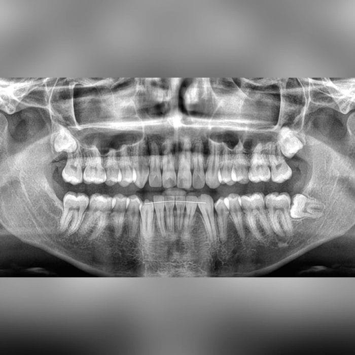 Dental Ai Platform 4