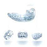 Dental Aligner 2