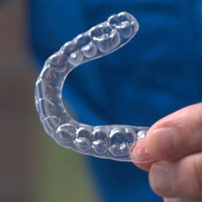 Dental Aligner 2