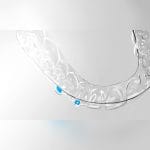 Dental Aligner 3