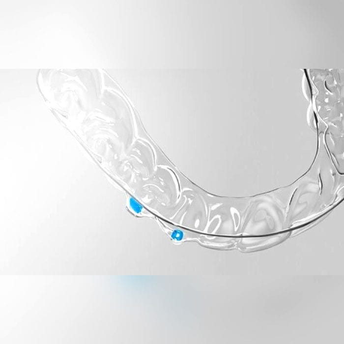 Dental Aligner 3