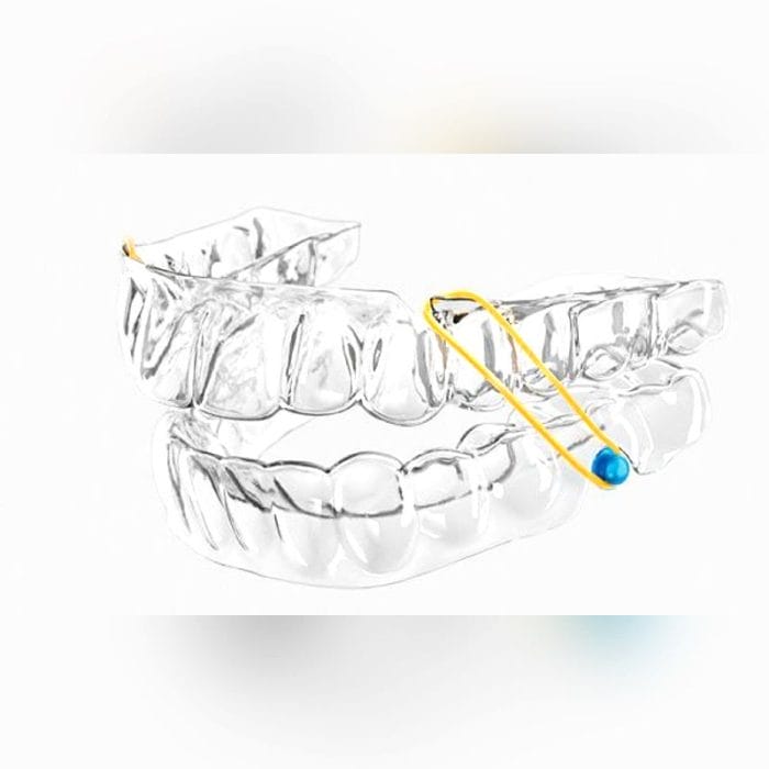 Dental Aligner 4