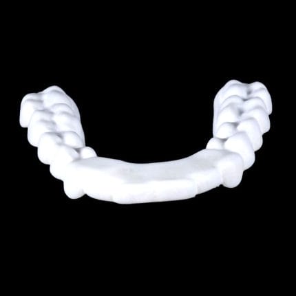 Dental Alignment Dental Splint