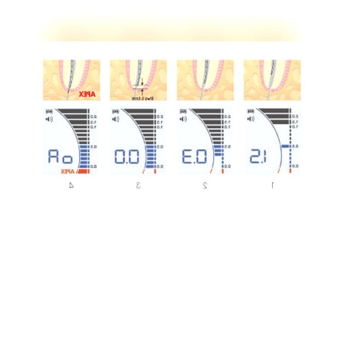 Dental Apex Locator 2