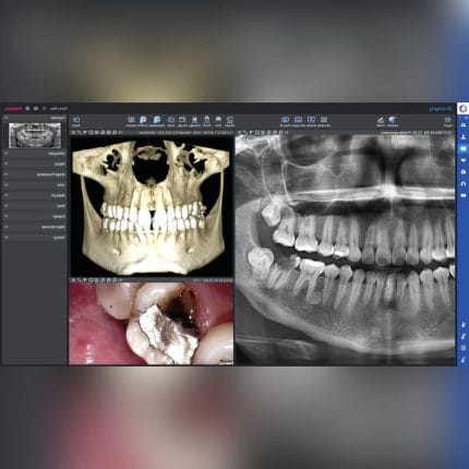 Dental Imaging Software 1