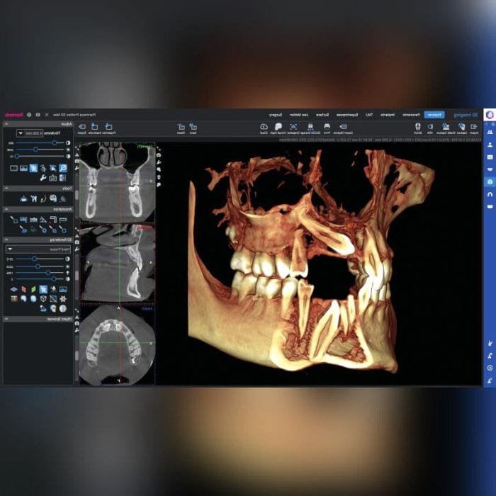 Dental Imaging Software 2