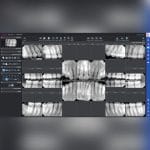 Dental Imaging Software 4