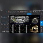 Dental Imaging Software 1