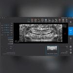 Dental Imaging Software 2