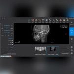 Dental Imaging Software 3