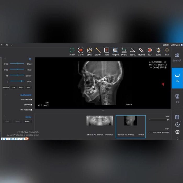 Dental Imaging Software 3