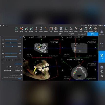 Dental Imaging Software