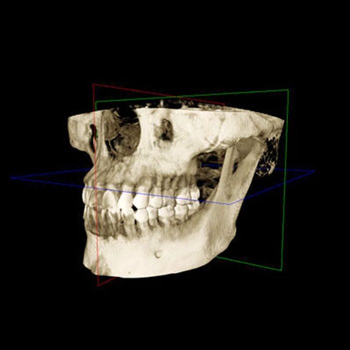 Dental Imaging Software 5