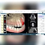 Dental Imaging Software 5