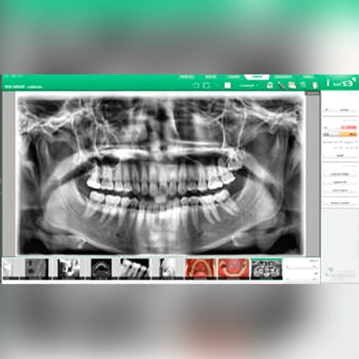 Dental Imaging Software 1