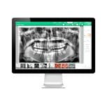 Dental Imaging Software