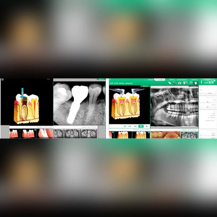 Dental Imaging Software 2