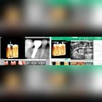 Dental Imaging Software 3