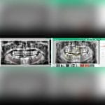 Dental Imaging Software 4