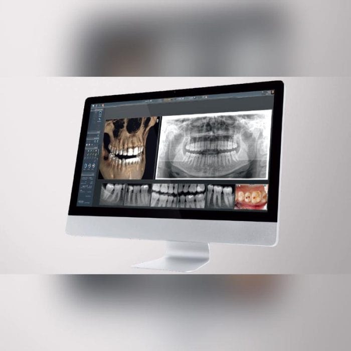 Dental Imaging Software 1