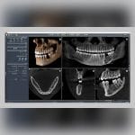 Dental Imaging Software 5