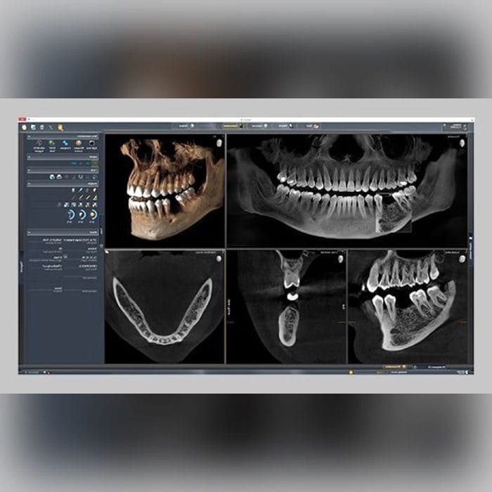 Dental Imaging Software 5