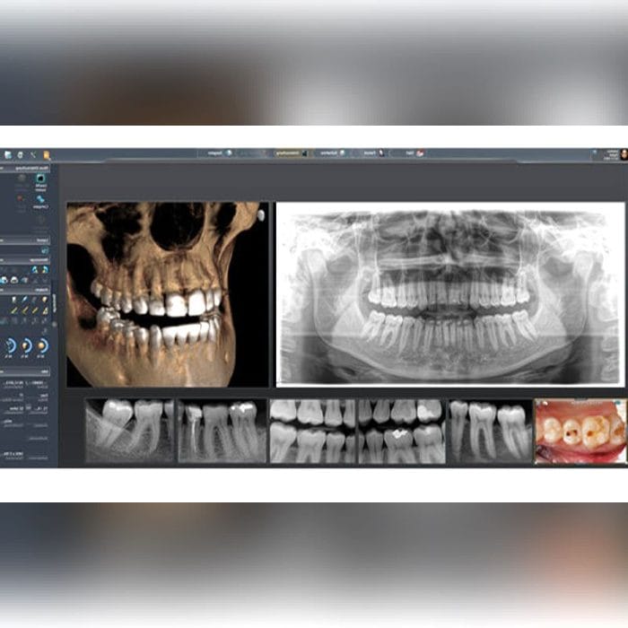 Dental Imaging Software 7