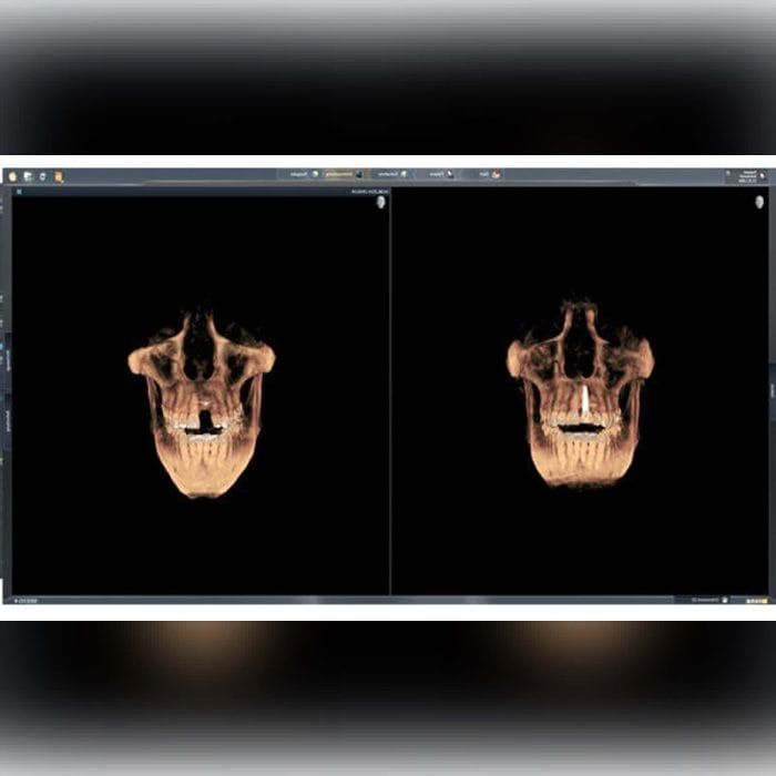 Dental Imaging Software 9