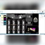 Dental Implantology Software 2