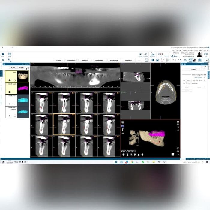 Dental Implantology Software 2