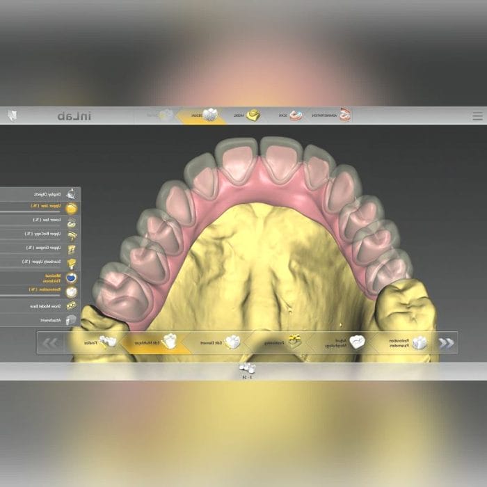 Dental Laboratory Software 2