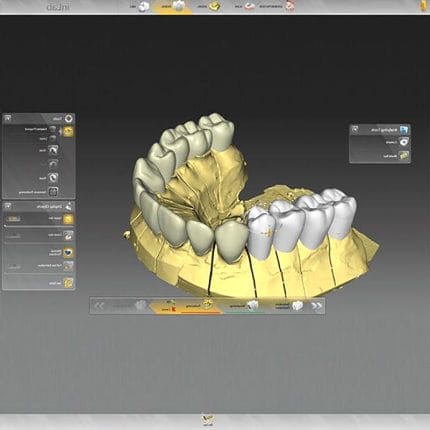 Dental Laboratory Software