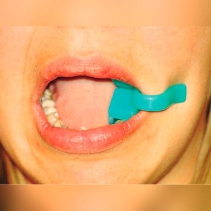 Dental Mouth Gag 1