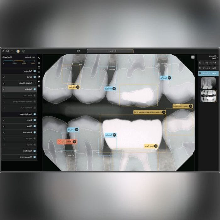 Dental Radiography Ai Platform 1