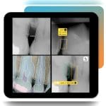 Dental Radiography Ai Platform 2