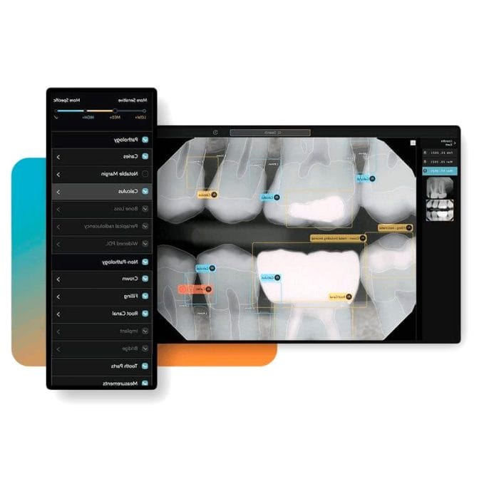 Dental Radiography Ai Platform