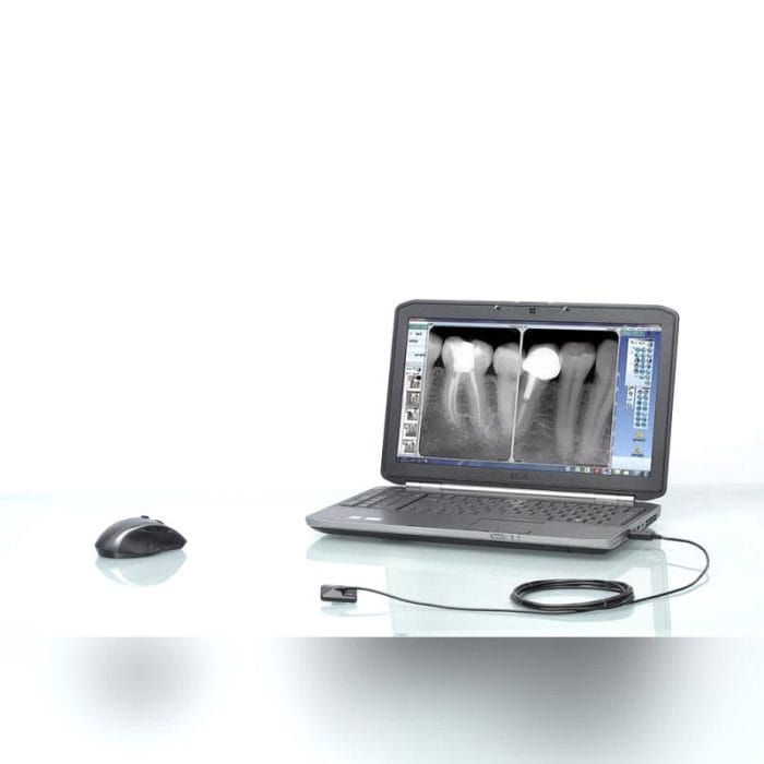 Dental Radiography Intra-Oral Detector 5