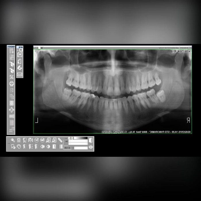 Dental Software 2