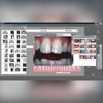 Dental Software 6