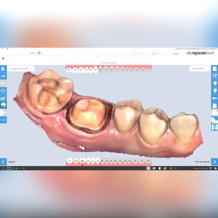 Dental Software 3