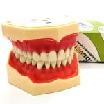 Denture Model 4