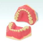 Denture Model 1