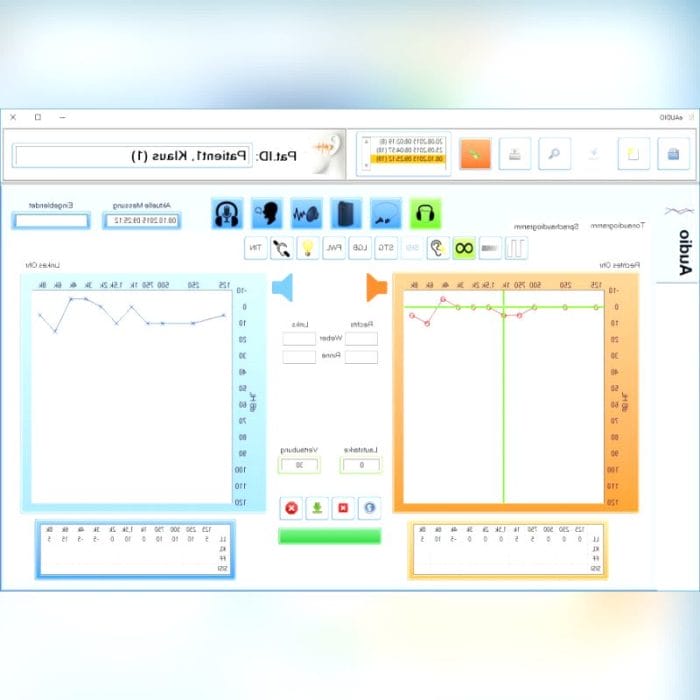 Diagnostic Audiometer 1