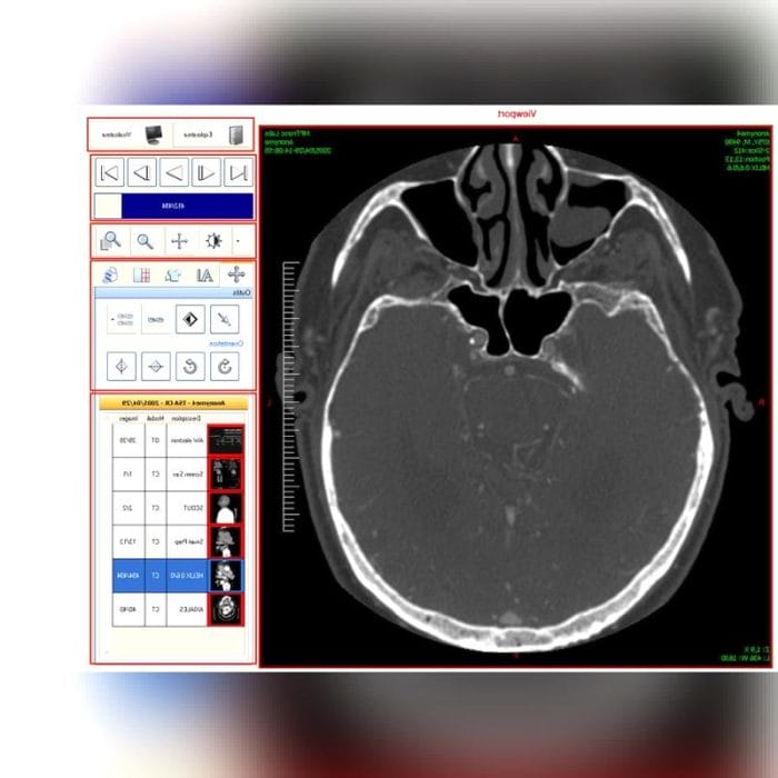 Dicom File Software